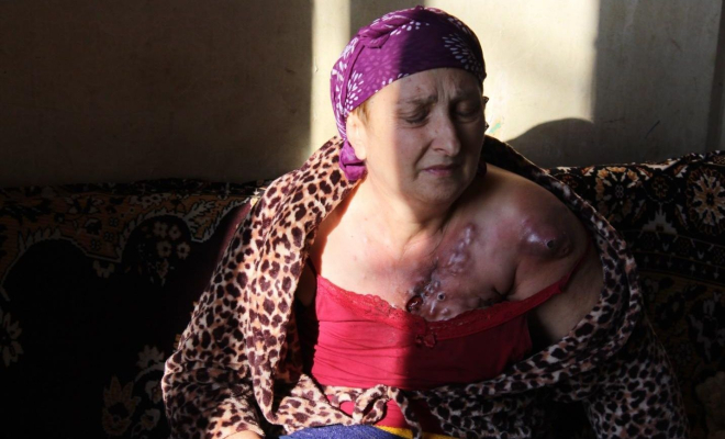 These are the last days in anticipation of death. It is impossible to convey this horror with words. A terminally ill woman takes a three-and-half hour's trip from a remote village to Tbilisi to get chemotherapy!